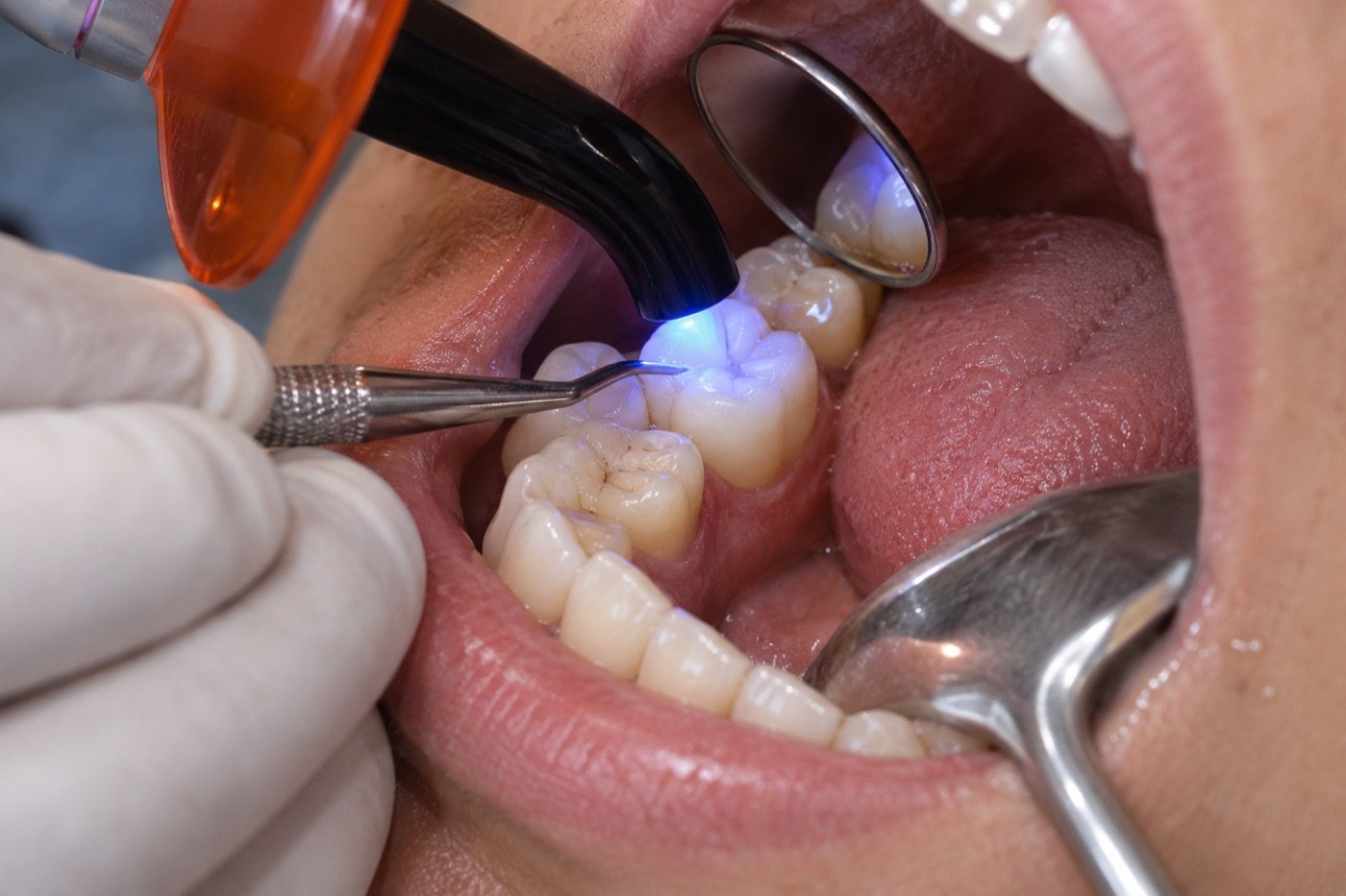 Restorative Dentistry
